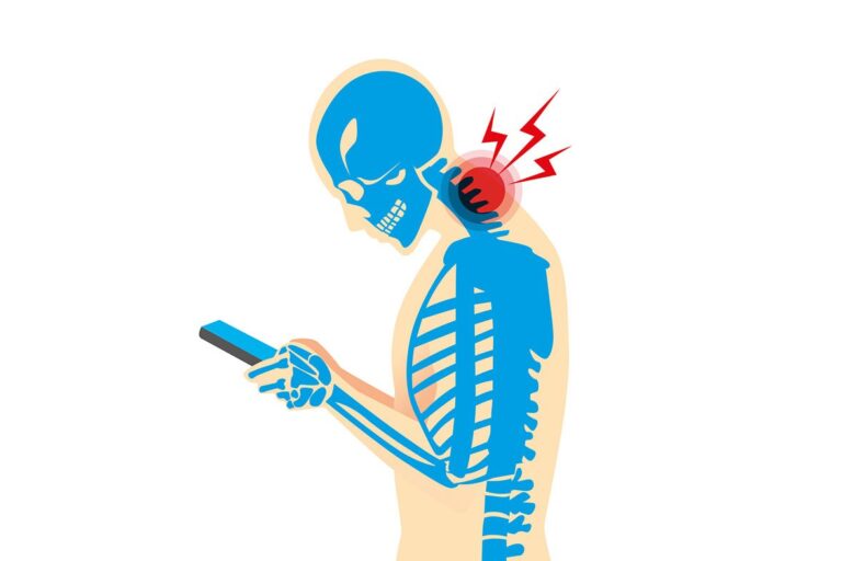 Smartphone neck pain illustration
